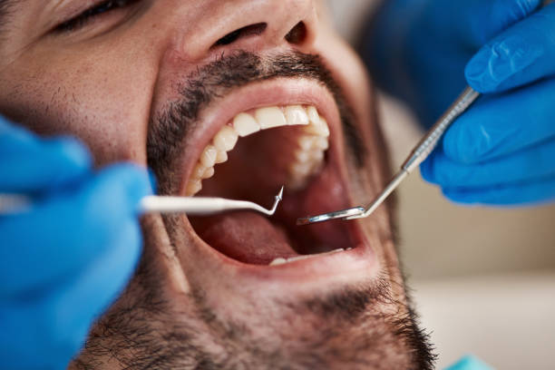 Best Emergency Treatment for Dental Infections or Abscesses in Rural Retreat, VA